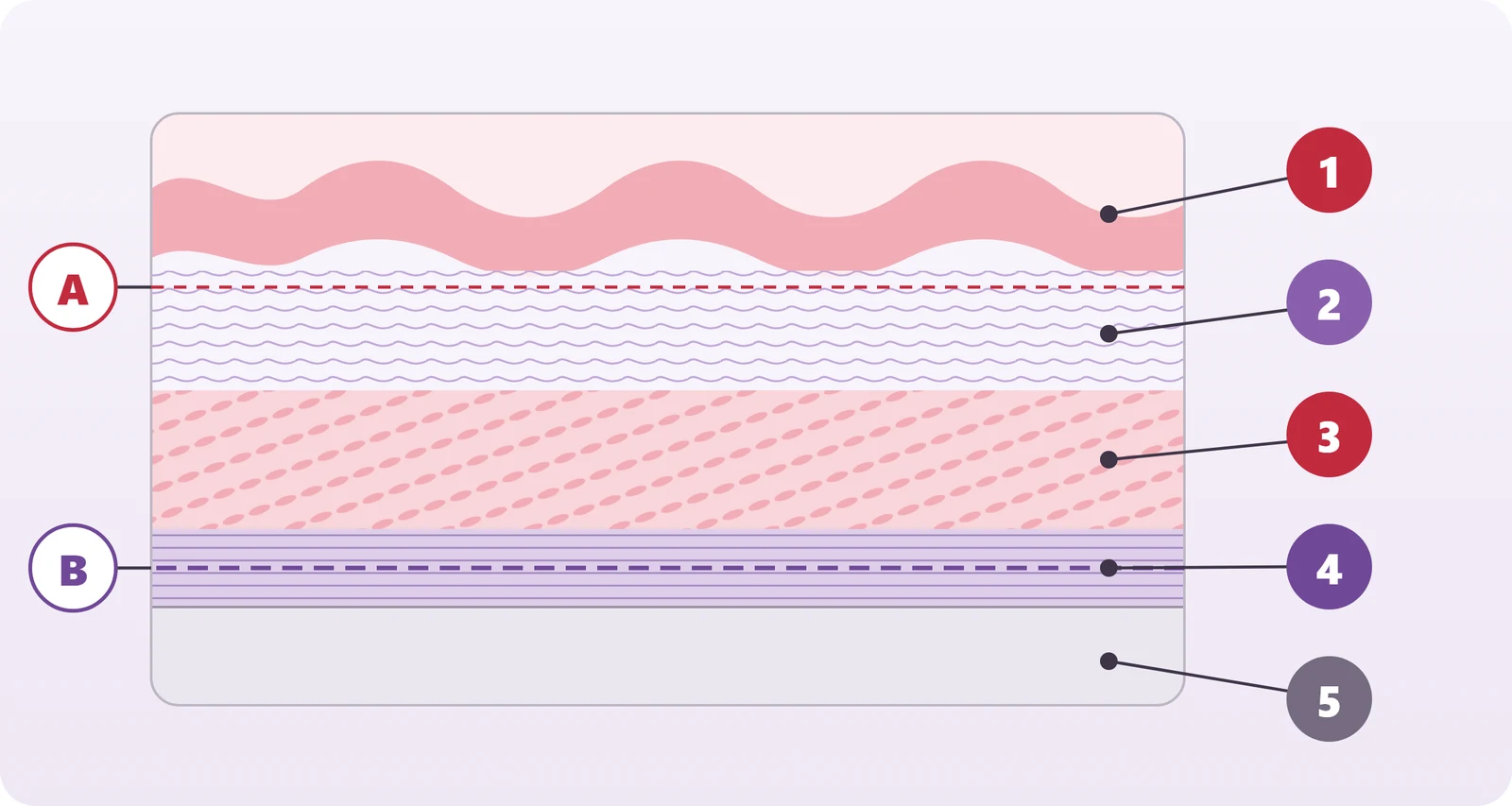 Diagram showing the layers of the vaginal wall: epithelium, lamina propria, smooth muscle, fascia, and adjacent organ; superficial and deep repair planes are marked with dashed lines